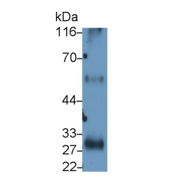 Interleukin 2 Receptor Alpha (IL2Ra) Human Monoclonal Antibody