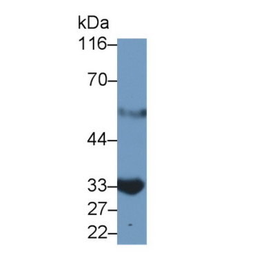 Interleukin 2 Receptor Alpha (IL2Ra) Human Monoclonal Antibody