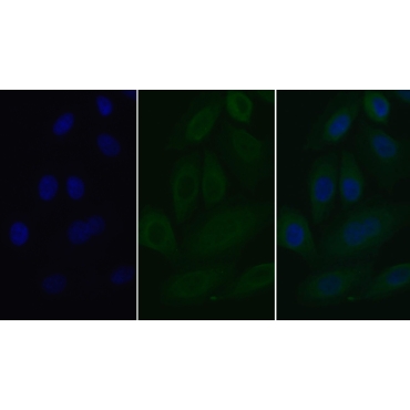 Interleukin 2 Receptor Alpha (IL2Ra) Human Monoclonal Antibody