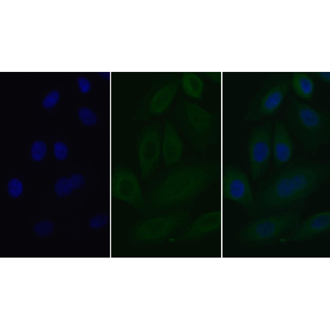 Interleukin 2 Receptor Alpha (IL2Ra) Human Monoclonal Antibody