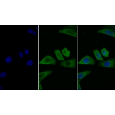 Interleukin 2 Receptor Alpha (IL2Ra) Human Monoclonal Antibody