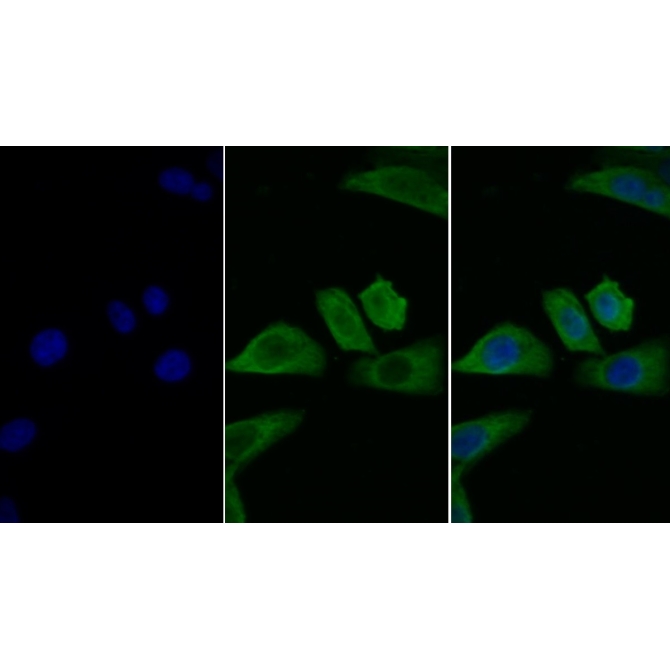 Interleukin 2 Receptor Alpha (IL2Ra) Human Monoclonal Antibody