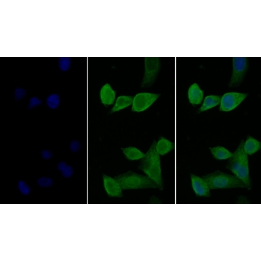 Interleukin 2 Receptor Alpha (IL2Ra) Human Monoclonal Antibody