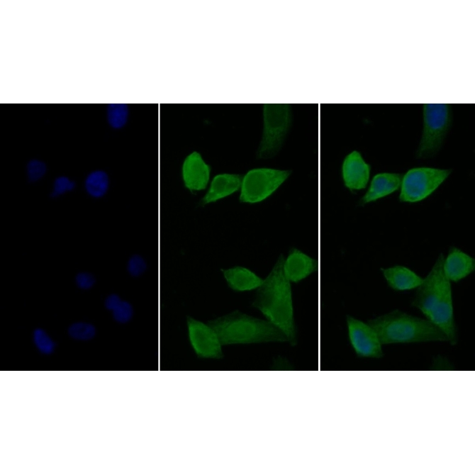Interleukin 2 Receptor Alpha (IL2Ra) Human Monoclonal Antibody