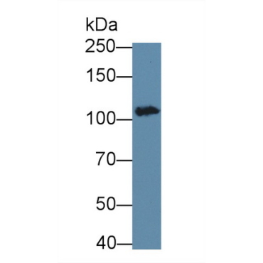 Vinculin (VCL) Human Monoclonal Antibody