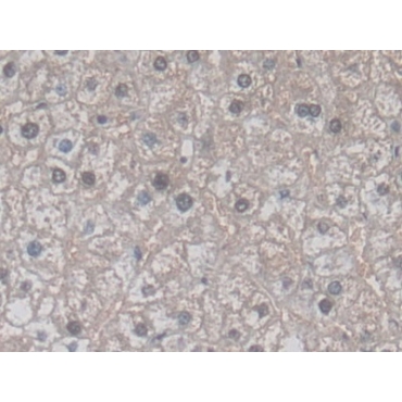 Vascular Endothelial Growth Factor 121 (VEGF121) Human Monoclonal Antibody