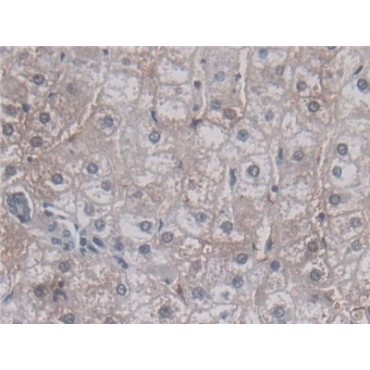 Vascular Endothelial Growth Factor 121 (VEGF121) Human Monoclonal Antibody