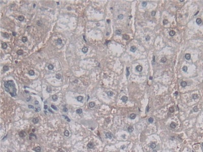Vascular Endothelial Growth Factor 121 (VEGF121) Human Monoclonal Antibody