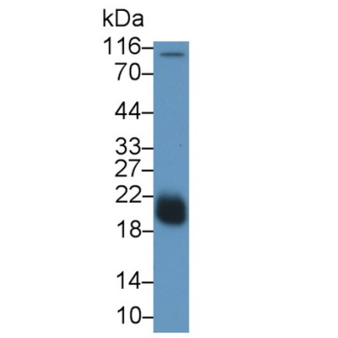 Lectin Like Oxidized Low Density Lipoprotein Receptor 1 (LOX1) Human Monoclonal Antibody