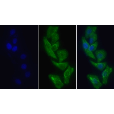 Lectin Like Oxidized Low Density Lipoprotein Receptor 1 (LOX1) Human Monoclonal Antibody