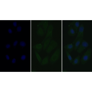 Lectin Like Oxidized Low Density Lipoprotein Receptor 1 (LOX1) Human Monoclonal Antibody