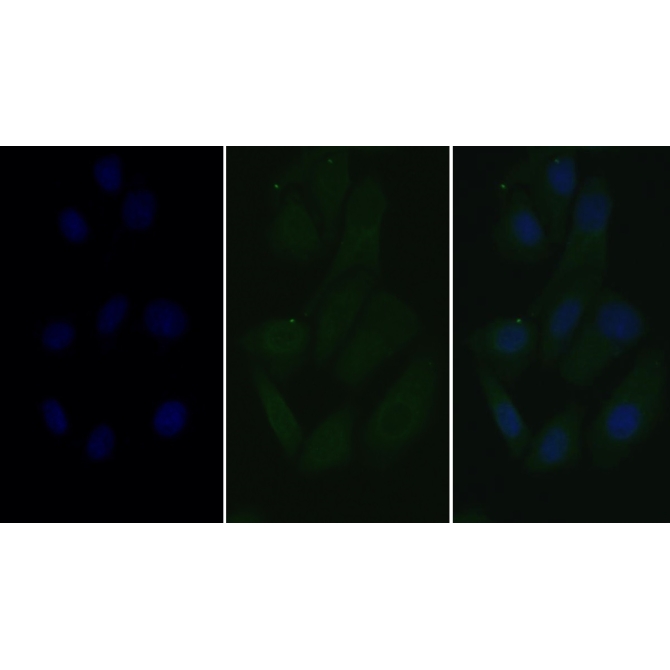 Lectin Like Oxidized Low Density Lipoprotein Receptor 1 (LOX1) Human Monoclonal Antibody
