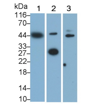 Lectin Like Oxidized Low Density Lipoprotein Receptor 1 (LOX1) Human Monoclonal Antibody