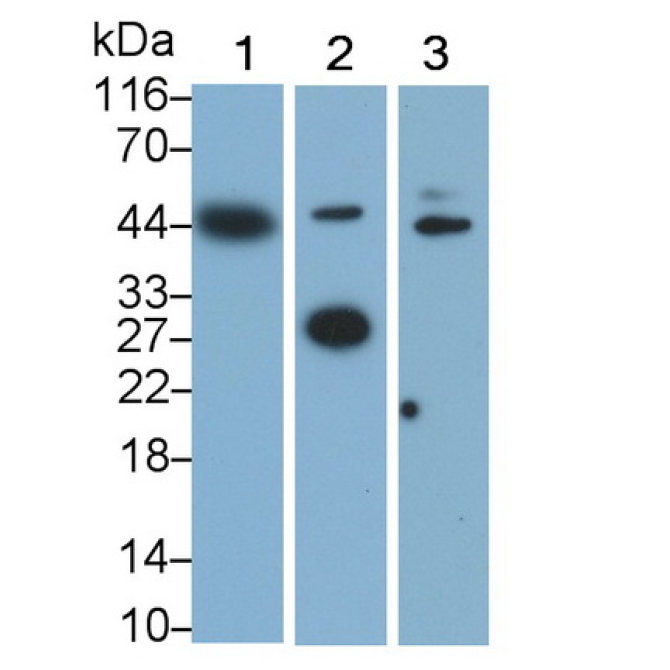 Lectin Like Oxidized Low Density Lipoprotein Receptor 1 (LOX1) Human Monoclonal Antibody