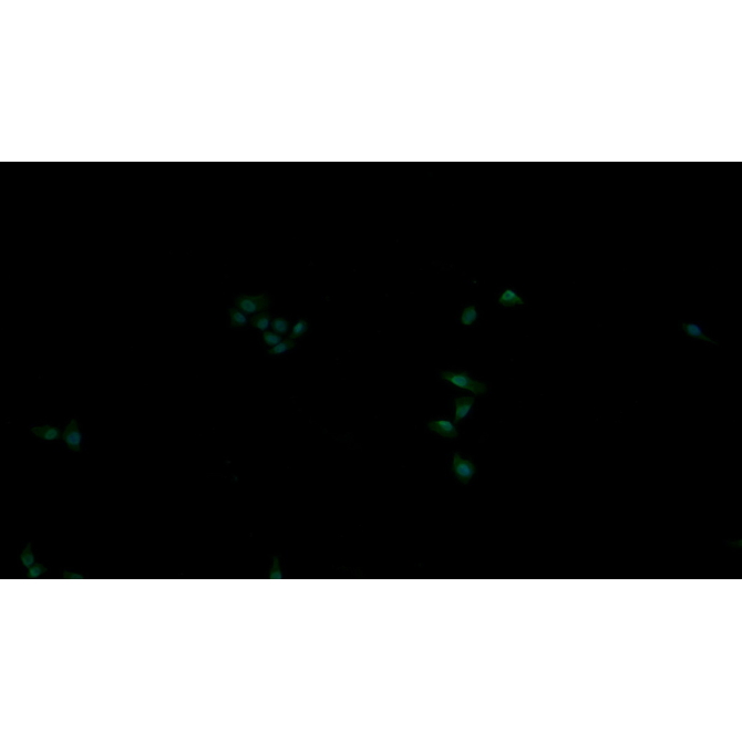 Receptor Tyrosine Protein Kinase erbB-2 (ErbB2) Human Monoclonal Antibody