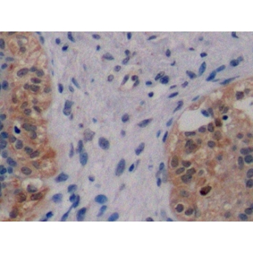 Receptor Tyrosine Protein Kinase erbB-2 (ErbB2) Human Monoclonal Antibody