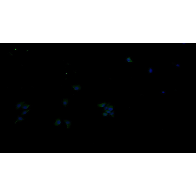 Receptor Tyrosine Protein Kinase erbB-2 (ErbB2) Human Monoclonal Antibody