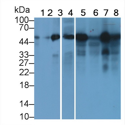 Tubulin Beta (TUBb) Human Monoclonal Antibody