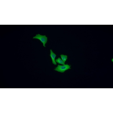 Tubulin Beta (TUBb) Human Monoclonal Antibody
