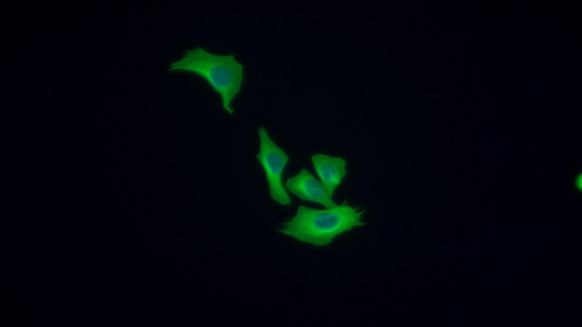 Tubulin Beta (TUBb) Human Monoclonal Antibody