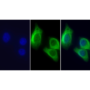 Tubulin Beta (TUBb) Human Monoclonal Antibody