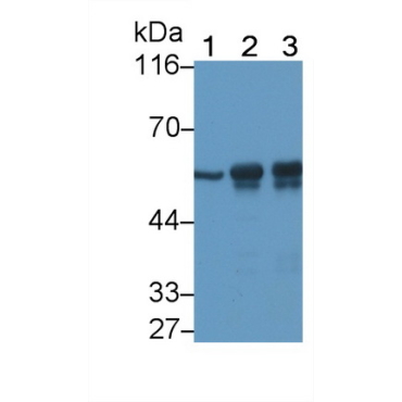 Tubulin Beta (TUBb) Human Monoclonal Antibody
