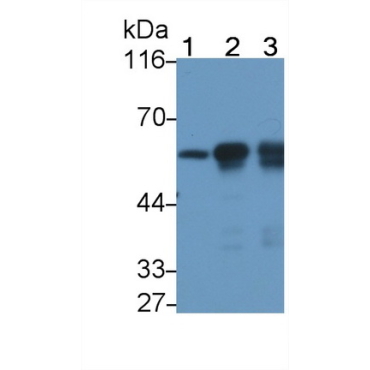 Tubulin Beta (TUBb) Human Monoclonal Antibody
