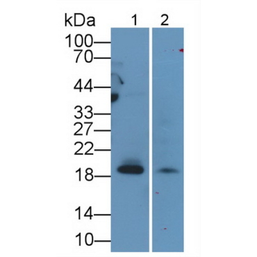 Cluster Of Differentiation 3d (CD3d) Human Monoclonal Antibody