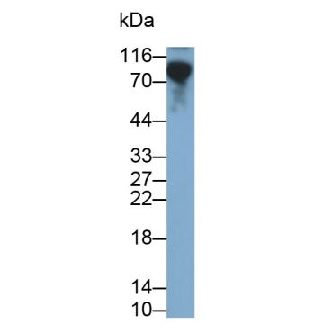 Cluster Of Differentiation 19 (CD19) Human Monoclonal Antibody