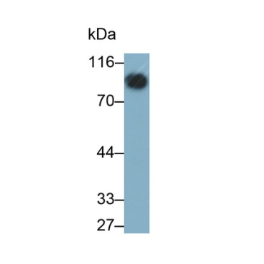 Cluster Of Differentiation 19 (CD19) Human Monoclonal Antibody