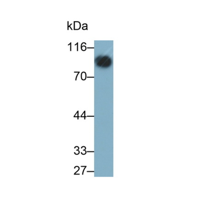 Cluster Of Differentiation 19 (CD19) Human Monoclonal Antibody