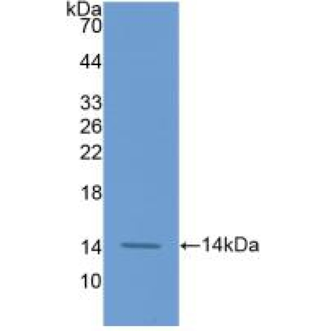 Coagulation Factor VII (F7) Human Monoclonal Antibody