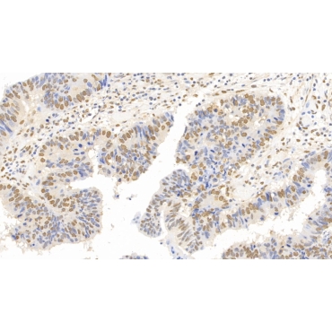 Forkhead Box P3 (FOXP3) Human Monoclonal Antibody