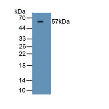 Forkhead Box P3 (FOXP3) Mouse Monoclonal Antibody