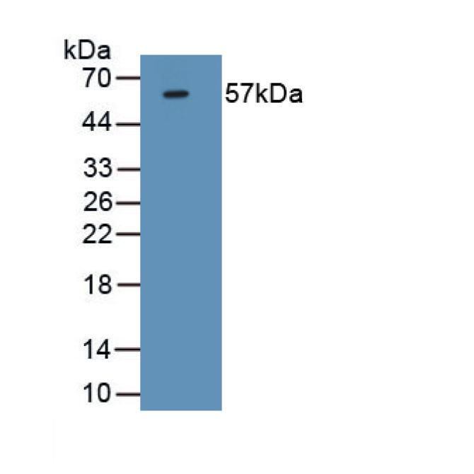 Forkhead Box P3 (FOXP3) Mouse Monoclonal Antibody