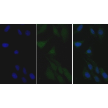 Apolipoprotein B48 (APOB48) Human Monoclonal Antibody