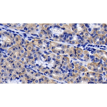 Angiotensin I Converting Enzyme 2 (ACE2) Human Monoclonal Antibody