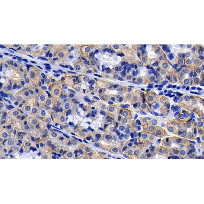 Angiotensin I Converting Enzyme 2 (ACE2) Human Monoclonal Antibody