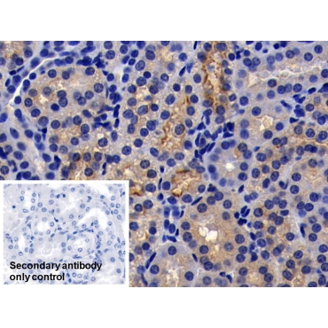 Angiotensin I Converting Enzyme 2 (ACE2) Human Monoclonal Antibody