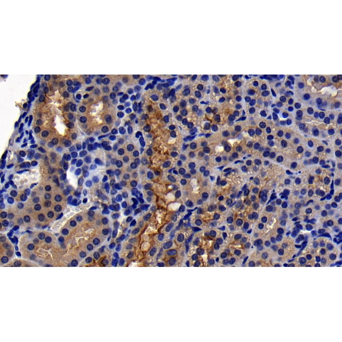 Angiotensin I Converting Enzyme 2 (ACE2) Human Monoclonal Antibody