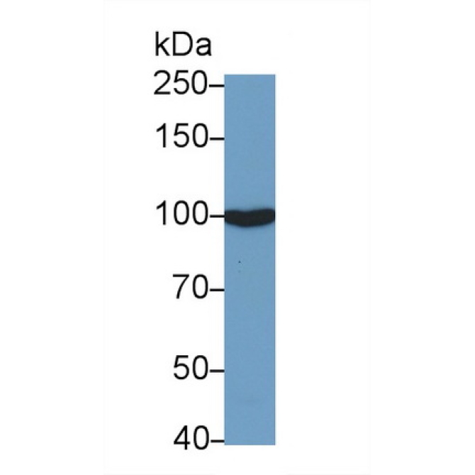 Angiotensin I Converting Enzyme 2 (ACE2) Human Monoclonal Antibody