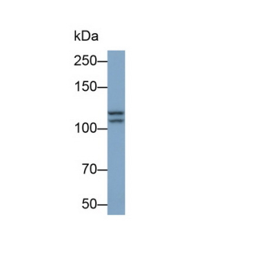 Insulin Degrading Enzyme (IDE) Human Monoclonal Antibody