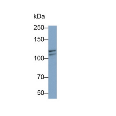 Insulin Degrading Enzyme (IDE) Human Monoclonal Antibody