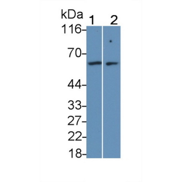 Interleukin 7 Receptor (IL7R) Human Monoclonal Antibody