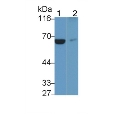 Interleukin 7 Receptor (IL7R) Human Monoclonal Antibody