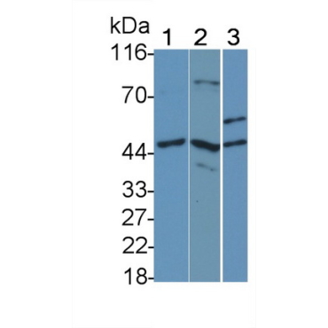 Interleukin 7 Receptor (IL7R) Human Monoclonal Antibody