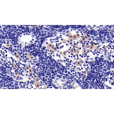 Interleukin 7 Receptor (IL7R) Human Monoclonal Antibody