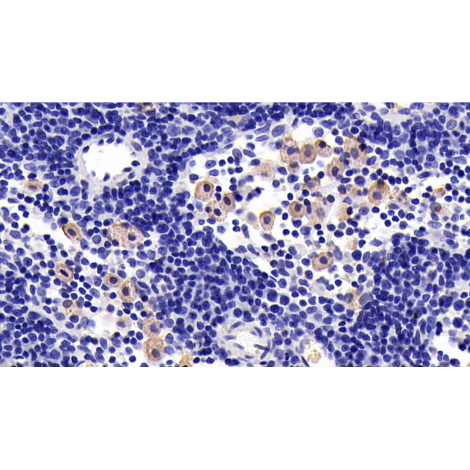 Interleukin 7 Receptor (IL7R) Human Monoclonal Antibody