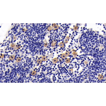 Interleukin 7 Receptor (IL7R) Human Monoclonal Antibody