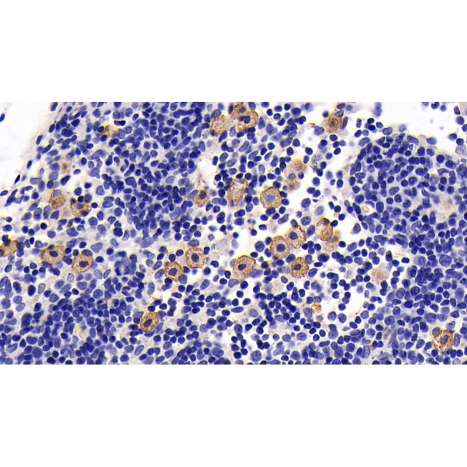 Interleukin 7 Receptor (IL7R) Human Monoclonal Antibody